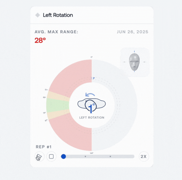 Interactive neck mobility report showing left rotation limited to 28 degrees. Circular gauge with red, yellow, and green zones highlights restricted range of motion, with head rotation icon and 3D head model for visual reference
